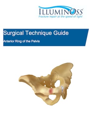 Surgical Technique Guide Anterior Ring of the Pelvis (900598)