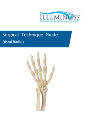 Surgical Technique Guide Distal Radius (900523)