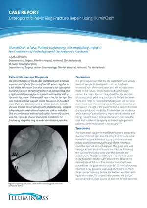 Osteoporotic Pelvic Ring Fracture Repair Using IlluminOss (900481)
