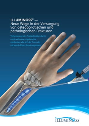 900490_B Radius Sales Brochure (German)